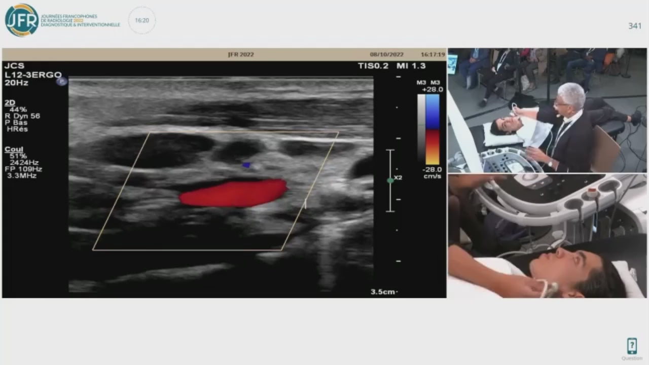 Maîtrisez l’Écho-Doppler Vasculaire – 35 h de Formation Vidéo HD (Théorie + Pratique + Cas Réels)